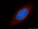 ATF6B Antibody in Immunocytochemistry (ICC/IF)