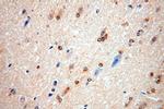 ATF6B Antibody in Immunohistochemistry (Paraffin) (IHC (P))