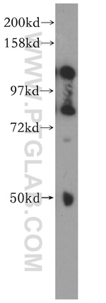 ATF6B Antibody in Western Blot (WB)