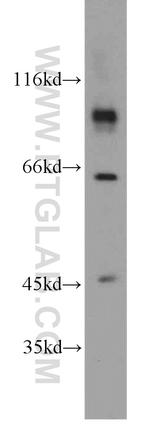 CHPF-N terminal Antibody in Western Blot (WB)