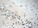 NHP2L1 Antibody in Immunohistochemistry (Paraffin) (IHC (P))