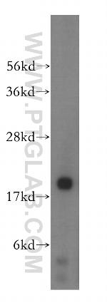 NAT5 Antibody in Western Blot (WB)