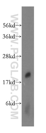 NAT5 Antibody in Western Blot (WB)