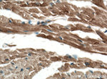 Alpha B Crystallin Antibody in Immunohistochemistry (Paraffin) (IHC (P))