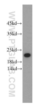 Alpha B Crystallin Antibody in Western Blot (WB)