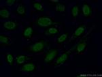 Alpha B Crystallin Antibody in Immunocytochemistry (ICC/IF)