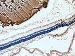 Alpha B Crystallin Antibody in Immunohistochemistry (Paraffin) (IHC (P))