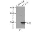 Alpha B Crystallin Antibody in Immunoprecipitation (IP)