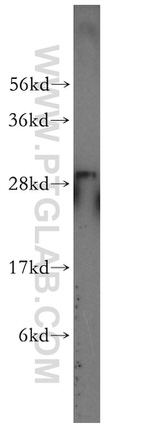 ANP32A Antibody in Western Blot (WB)