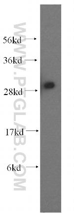 ANP32A Antibody in Western Blot (WB)