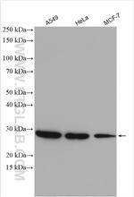 ANP32A Antibody in Western Blot (WB)