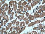 UBE2O Antibody in Immunohistochemistry (Paraffin) (IHC (P))