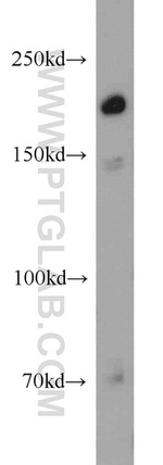 UBE2O Antibody in Western Blot (WB)