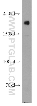 UBE2O Antibody in Western Blot (WB)