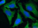 PRDX1 Antibody in Immunocytochemistry (ICC/IF)