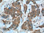 PRDX1 Antibody in Immunohistochemistry (Paraffin) (IHC (P))