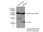 PRDX1 Antibody in Immunoprecipitation (IP)