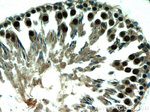 XRCC4 Antibody in Immunohistochemistry (Paraffin) (IHC (P))