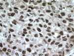 XRCC4 Antibody in Immunohistochemistry (Paraffin) (IHC (P))