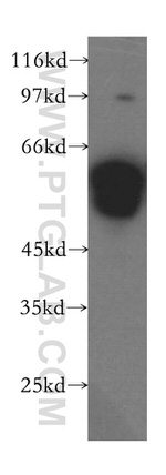 XRCC4 Antibody in Western Blot (WB)