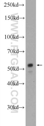 XRCC4 Antibody in Western Blot (WB)