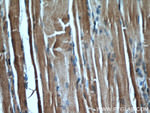 PKM1 Antibody in Immunohistochemistry (Paraffin) (IHC (P))