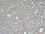 PKM1 Antibody in Immunohistochemistry (Paraffin) (IHC (P))