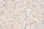 PKM1 Antibody in Immunohistochemistry (Paraffin) (IHC (P))