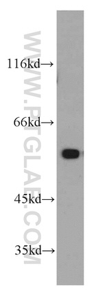 PKM1 Antibody in Western Blot (WB)