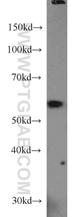 PKM1 Antibody in Western Blot (WB)