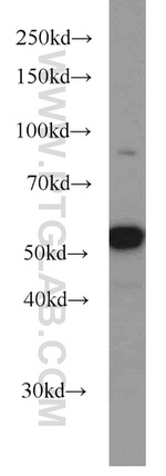 PKM1 Antibody in Western Blot (WB)