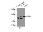 PKM1 Antibody in Immunoprecipitation (IP)