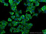 PKM2 Antibody in Immunocytochemistry (ICC/IF)