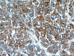 PKM2 Antibody in Immunohistochemistry (Paraffin) (IHC (P))