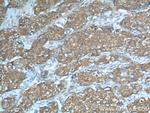 PKM2 Antibody in Immunohistochemistry (Paraffin) (IHC (P))