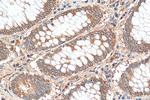 PKM2 Antibody in Immunohistochemistry (Paraffin) (IHC (P))