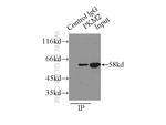 PKM2 Antibody in Immunoprecipitation (IP)