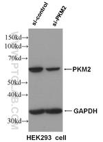 PKM2 Antibody in Western Blot (WB)