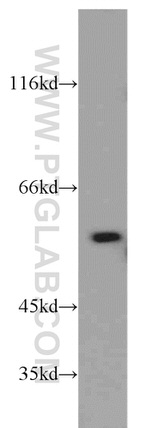 PKM2 Antibody in Western Blot (WB)