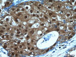 MCL1L Antibody in Immunohistochemistry (Paraffin) (IHC (P))