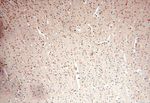 MCL1L Antibody in Immunohistochemistry (Paraffin) (IHC (P))