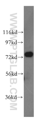 GARS Antibody in Western Blot (WB)