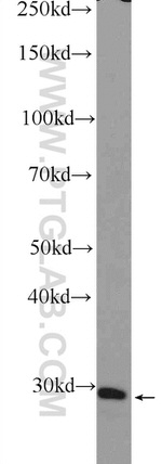 FOSL2 Antibody in Western Blot (WB)