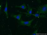 Vitronectin Antibody in Immunocytochemistry (ICC/IF)