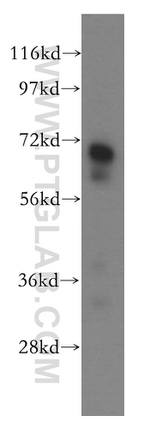 Vitronectin Antibody in Western Blot (WB)