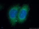 C4BPB Antibody in Immunocytochemistry (ICC/IF)