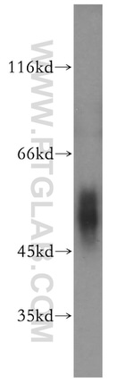 C4BPB Antibody in Western Blot (WB)