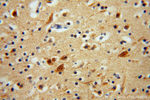 GSTT1 Antibody in Immunohistochemistry (Paraffin) (IHC (P))