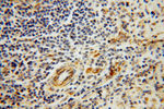 GSTT1 Antibody in Immunohistochemistry (Paraffin) (IHC (P))