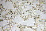 GSTT1 Antibody in Immunohistochemistry (Paraffin) (IHC (P))